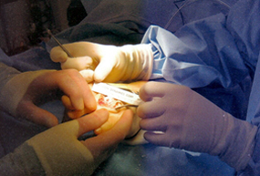 Surrey podiatry riar surgery