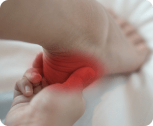 Haglund’s Deformity