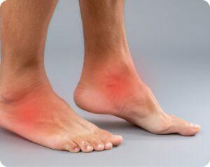 Peripheral Artery Disease