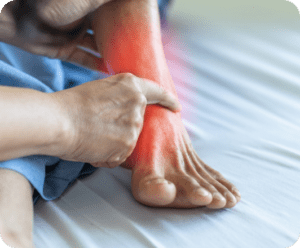 Posterior Tibial Tendon Dysfunction